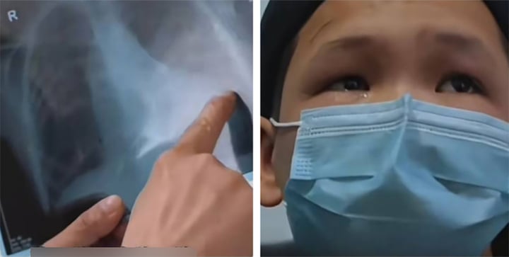 Cậu bé có trái tim biến dạng như một chiếc giày- Ảnh 1. Cậu bé có trái tim biến dạng như một chiếc giày- Ảnh 1.