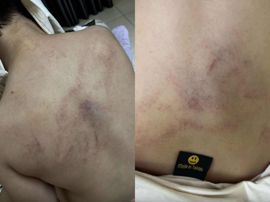 Nóng: Bé gái 4 tuổi bị cô giáo mầm non công lập ở Hà Nội bạo hành dã man, trích xuất camera phát hiện hành động gây sốc- Ảnh 1. Nóng: Bé gái 4 tuổi bị cô giáo mầm non công lập ở Hà Nội bạo hành dã man, trích xuất camera phát hiện hành động gây sốc- Ảnh 1.
