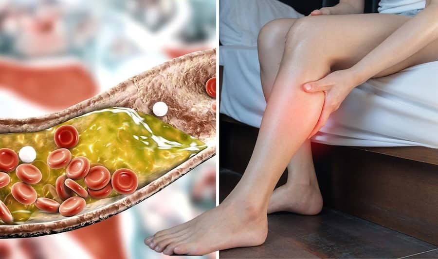 Sáng thức dậy mà gặp 6 dấu hiệu này ở đầu, coi chừng đột quỵ “đang tìm đến” bạn- Ảnh 2.