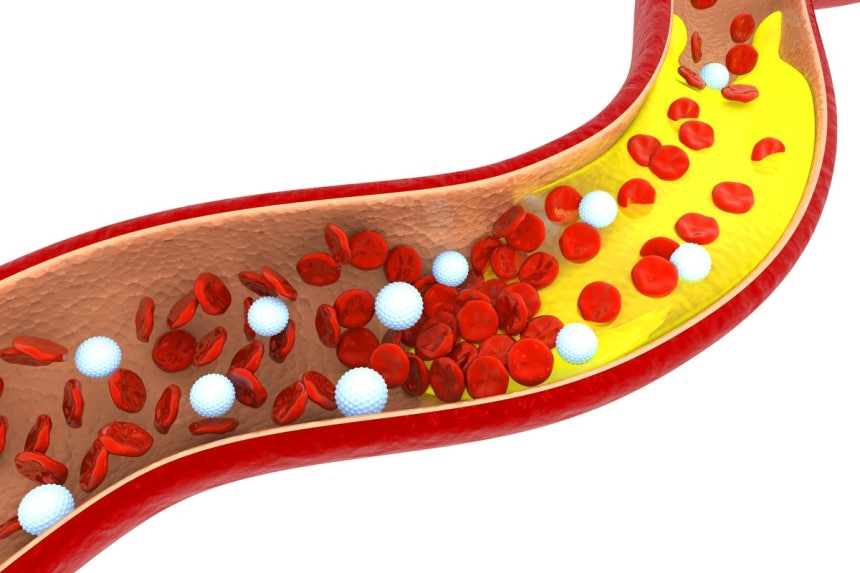 Mạch máu già đi chính là lý do bạn già nhanh: Làm ngay 4 việc để mạch máu sạch và khỏe- Ảnh 1.