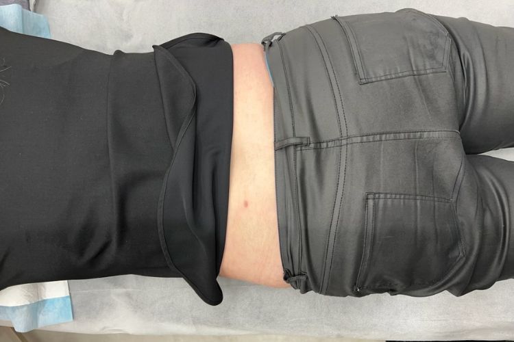 KIỂM TRA NGAY: Nốt ruồi mọc ở 6 vị trí này trên cơ thể rất dễ "biến hình" thành ung thư!- Ảnh 1.