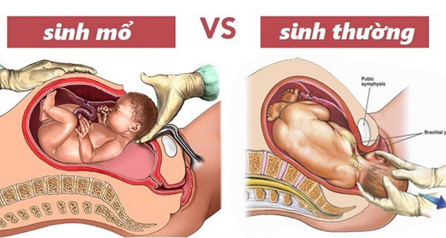 Bệnh viện Nhi Trung ương: Sản phụ mất con vì chọn ngày giờ đẹp để sinh mổ- Ảnh 2. Bệnh viện Nhi Trung ương: Sản phụ mất con vì chọn ngày giờ đẹp để sinh mổ- Ảnh 2.