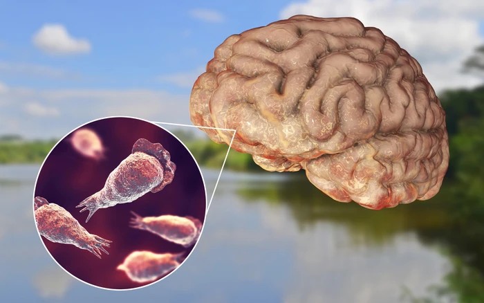 Phát hiện ‘amip ăn não’ trong nguồn nước sinh hoạt tại quốc gia có cộng đồng người Việt đông thứ 3 thế giới- Ảnh 1.