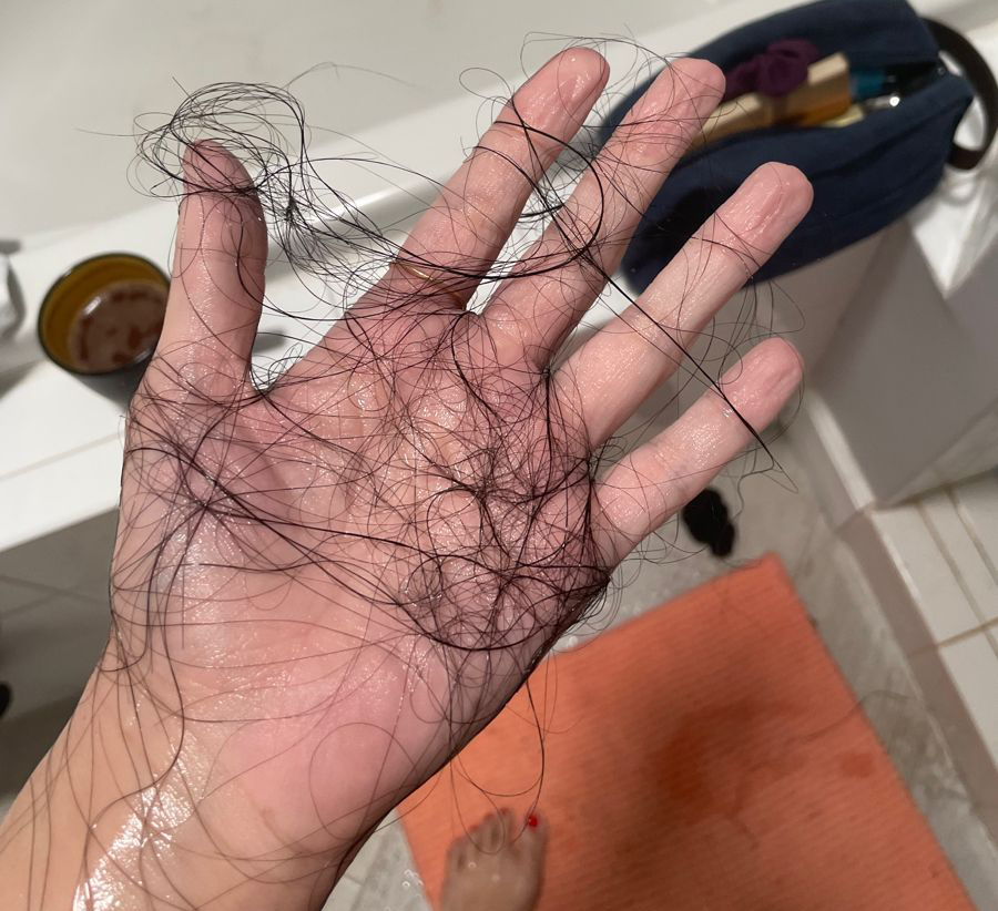 6 thực phẩm chứa cả "kho" biotin, giúp chị em tiền mãn kinh thoát khỏi nỗi lo rụng tóc, kích thích tóc con "mọc tua tủa"- Ảnh 1.