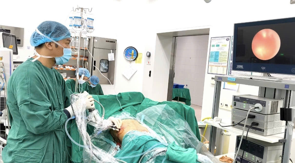 Nguy hiểm tính mạng vì quên ống sonde trong cơ thể suốt 2 năm- Ảnh 1.
