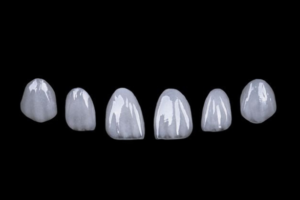 Dán sứ Veneer: Khi thẩm mỹ răng gắn liền bảo tồn- Ảnh 2. Dán sứ Veneer: Khi thẩm mỹ răng gắn liền bảo tồn- Ảnh 2.