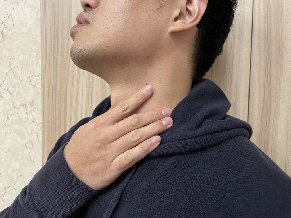 Uống 5 lon nước ngọt mỗi ngày, nam thanh niên trào ngược dạ dày 98 lần- Ảnh 1. Uống 5 lon nước ngọt mỗi ngày, nam thanh niên trào ngược dạ dày 98 lần- Ảnh 1.
