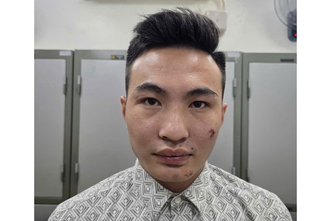 Lời khai bất ngờ của nam thanh niên sinh năm 2003 say xỉn, lái xe máy tông ngã cán bộ Công an làm nhiệm vụ A80- Ảnh 1. Lời khai bất ngờ của nam thanh niên sinh năm 2003 say xỉn, lái xe máy tông ngã cán bộ Công an làm nhiệm vụ A80- Ảnh 1.