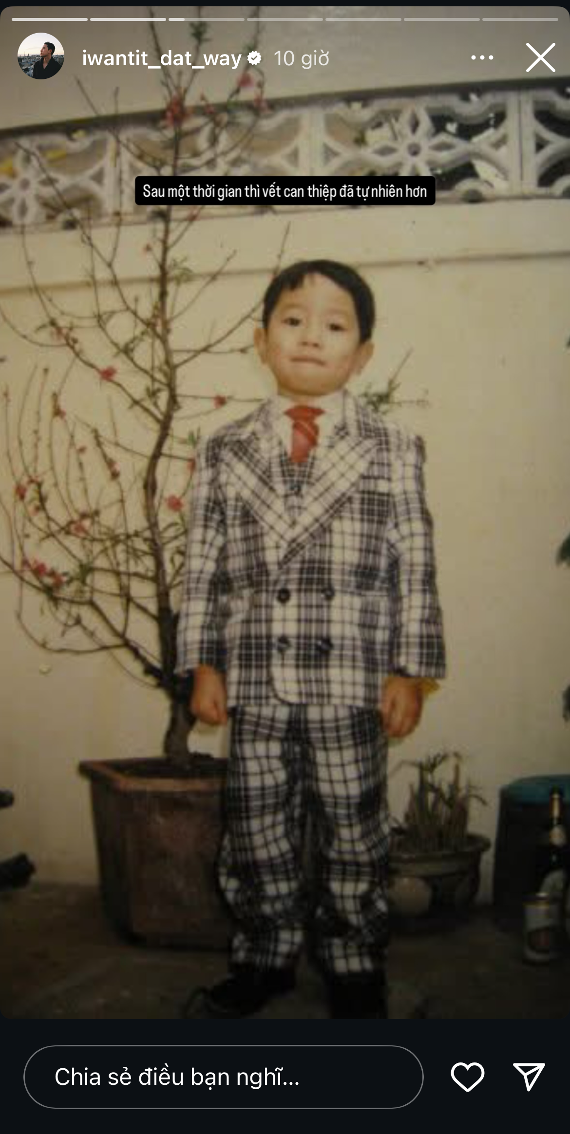 Giám đốc Quang Đạt "phẫu thuật" tạo má lúm từ năm... 4 tuổi- Ảnh 4. Giám đốc Quang Đạt "phẫu thuật" tạo má lúm từ năm... 4 tuổi- Ảnh 4.