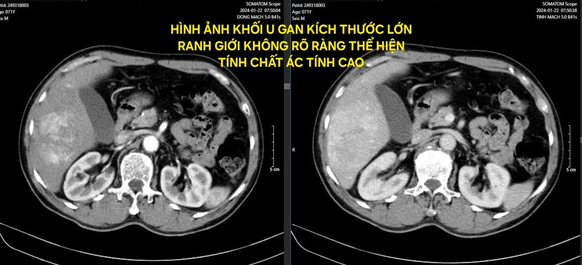 Mắc ung thư giai đoạn cuối, cụ ông kiên trì làm 1 việc khiến khối u biến mất hoàn toàn, bác sĩ nể phục- Ảnh 1.