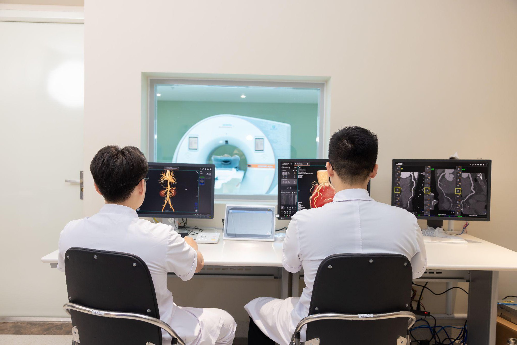 Ra mắt siêu máy CT đếm photon: Đột phá trong tầm soát đột quỵ- Ảnh 3.