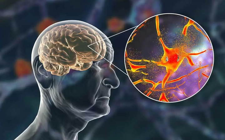 4 thói quen âm thầm hủy hoại não bộ: Điều thứ nhất và thứ 3 hầu như ai cũng có- Ảnh 1.