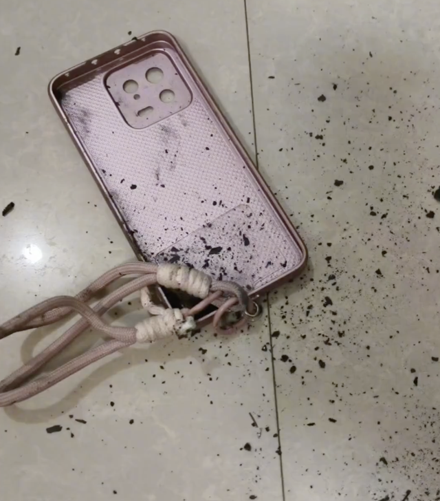 Bé trai 3 tuổi đang cầm điện thoại chơi thì thiết bị phát nổ, cả gia đình hoảng hốt chạy tới ứng cứu- Ảnh 2.