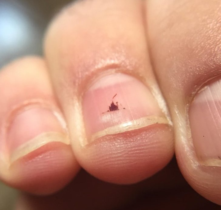 7 bất thường trên móng tay lộ ngay người “giấu” khối u trong cơ thể, kiểm tra xem bạn có không!- Ảnh 2.