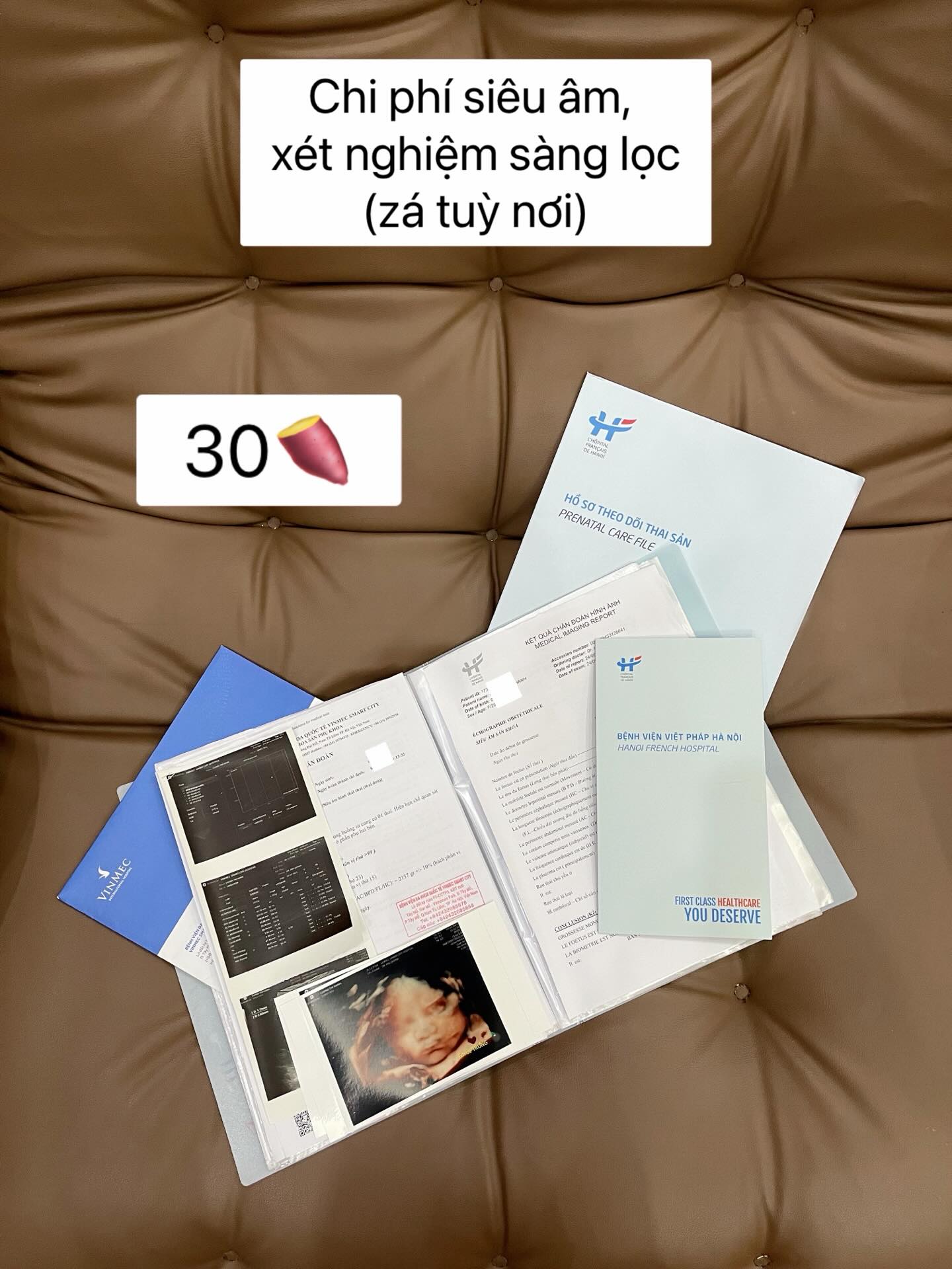 Viral Threads: Mẹ bỉm liệt kê chi phí sinh con gần 500 triệu, hội chưa đẻ tái mặt, choáng váng đến quay cuồng trời đất!- Ảnh 3. Viral Threads: Mẹ bỉm liệt kê chi phí sinh con gần 500 triệu, hội chưa đẻ tái mặt, choáng váng đến quay cuồng trời đất!- Ảnh 3.