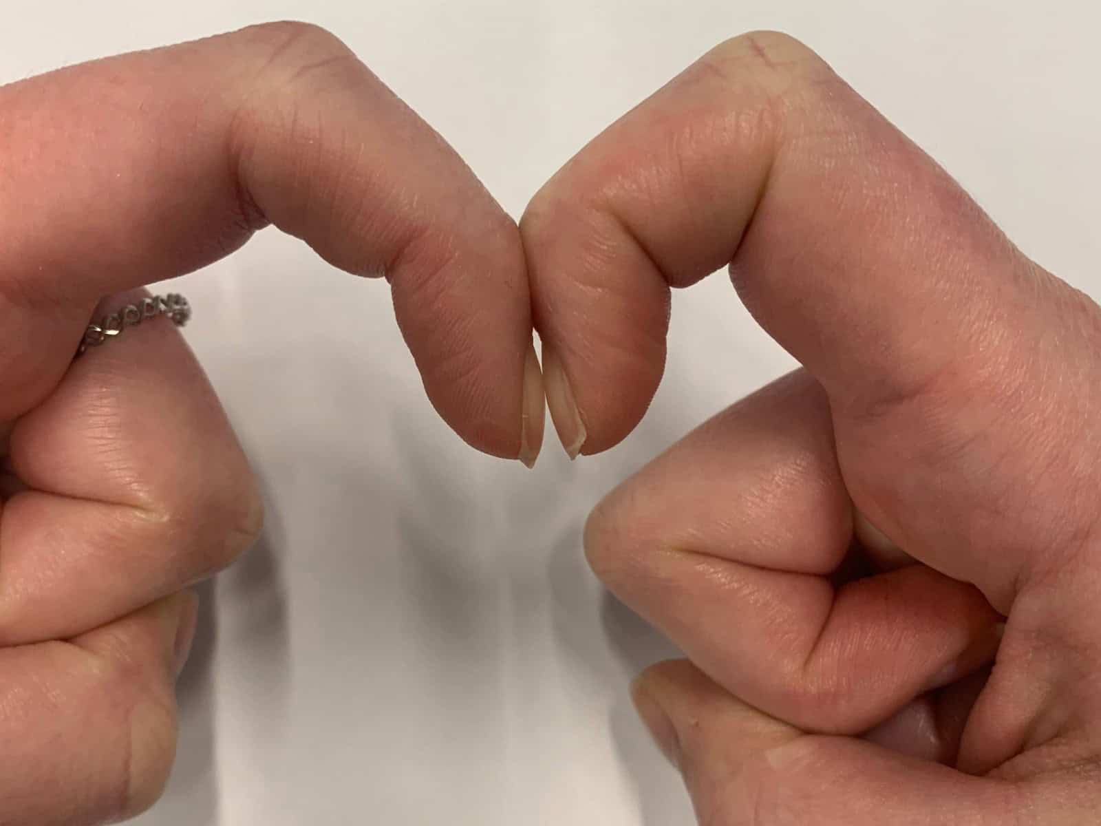 Những người có 5 bất thường này ở bàn tay khó tránh khỏi bệnh gan, có khi ung thư mà không biết!- Ảnh 2.