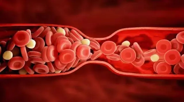 Ăn 3 loại thức ăn thường xuyên, mạch máu sẽ thông- Ảnh 1.