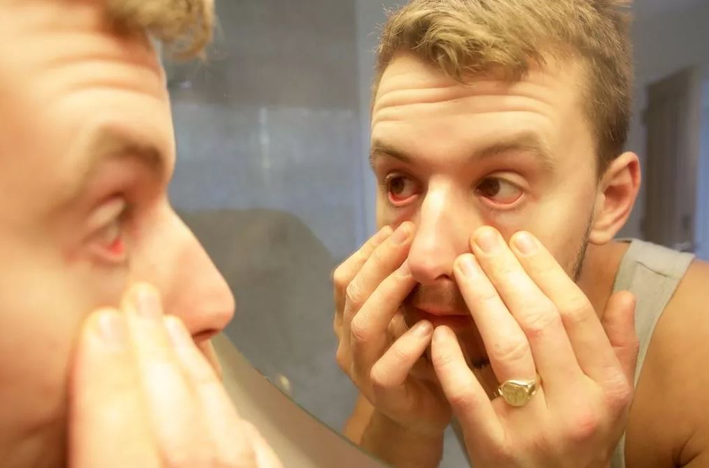 Ngủ dậy mà thấy gỉ mắt màu này, tốt nhất là nên đi khám- Ảnh 1.