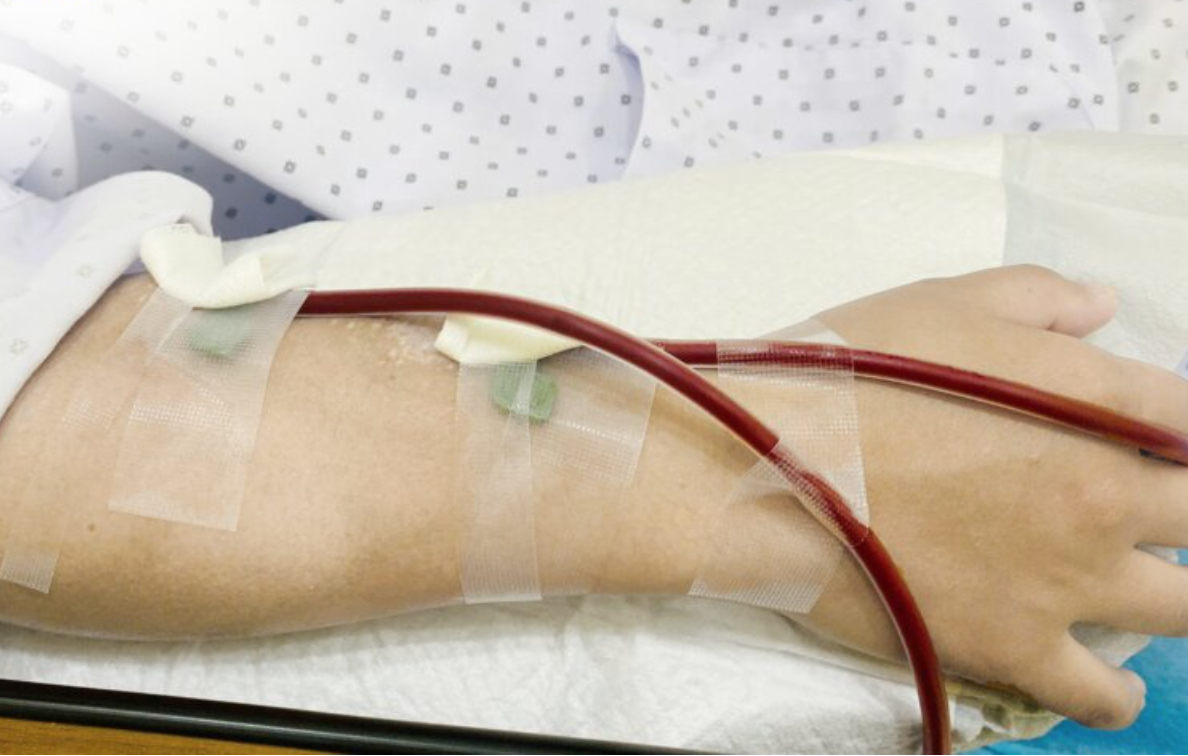 Ăn uống lành mạnh, chăm tập thể dục nhưng phải cắt cả 2 thận chỉ trong vòng 1 năm: "Thủ phạm" lộ diện- Ảnh 1.