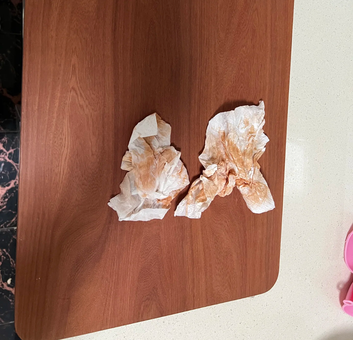 Nói thật: Dùng thớt sai cách thì cứ chờ… bệnh vào người, dẫn lối ung thư!- Ảnh 7.