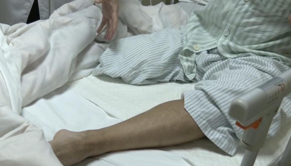 Người đàn ông bất ngờ phải cắt cụt bắp chân: Bác sĩ nói do chủ quan với 1 dấu hiệu bất thường- Ảnh 1. Người đàn ông bất ngờ phải cắt cụt bắp chân: Bác sĩ nói do chủ quan với 1 dấu hiệu bất thường- Ảnh 1.