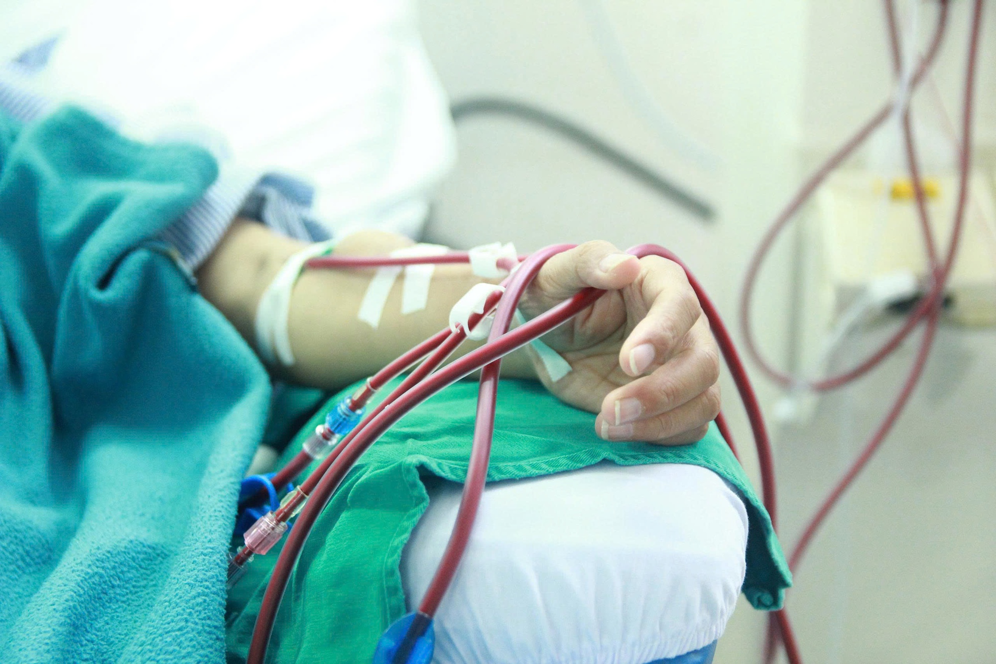 Khi thận suy hỏng, cơ thể sẽ sưng ở 1 vị trí: Rất nhiều người bỏ qua- Ảnh 3. Khi thận suy hỏng, cơ thể sẽ sưng ở 1 vị trí: Rất nhiều người bỏ qua- Ảnh 3.