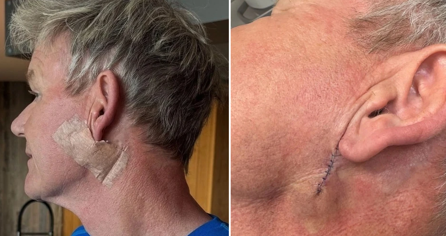 &quot;Vua đầu bếp&quot; Gordon Ramsay bị ung thư- Ảnh 1.