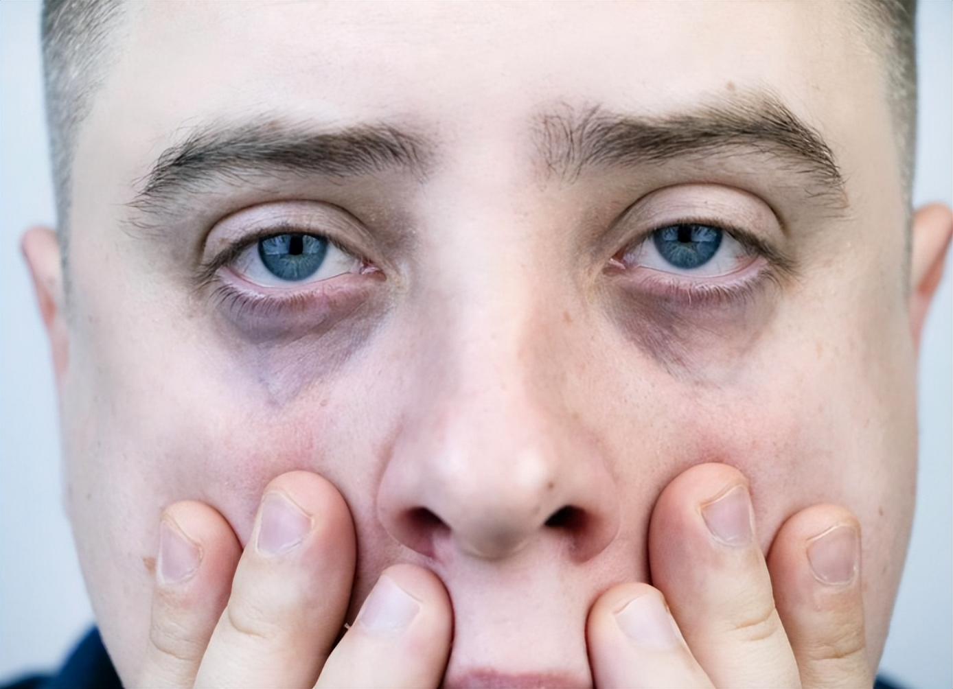 4 đặc điểm trên khuôn mặt báo hiệu bệnh tật hoặc ung thư: Đừng nhầm lẫn chúng với 4 đặc điểm trên khuôn mặt báo hiệu bệnh tật hoặc ung thư: Đừng nhầm lẫn chúng với