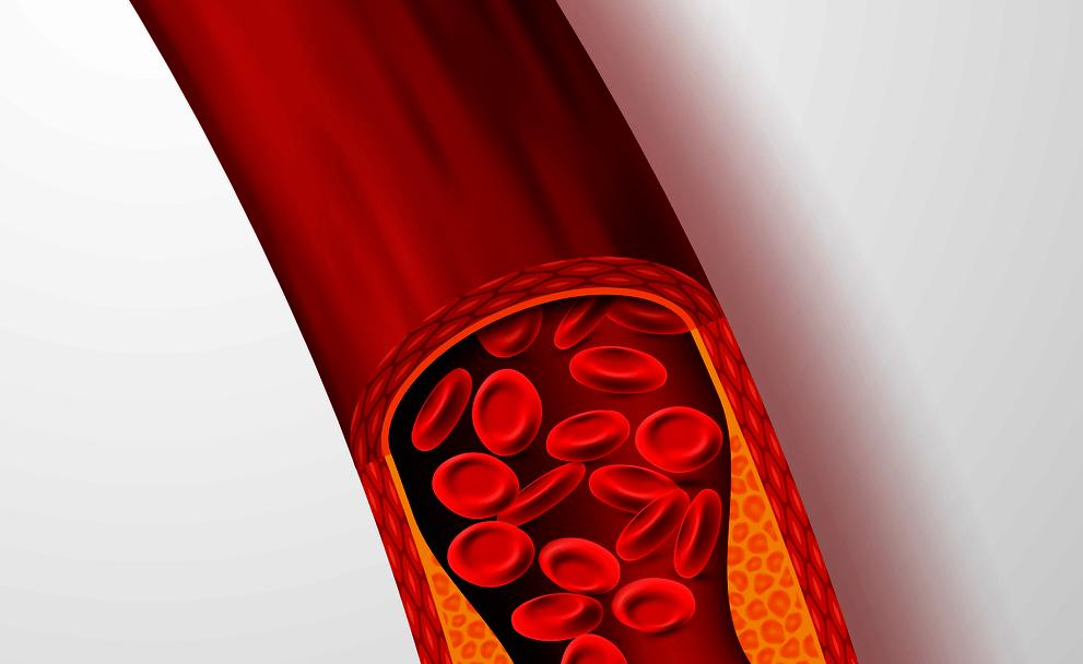 Không phải thuốc, đây là 5 nhóm thực phẩm khiến cục máu đông “sợ hãi”: Nhiều gia đình Việt vẫn không biết mà ăn- Ảnh 1. Không phải thuốc, đây là 5 nhóm thực phẩm khiến cục máu đông “sợ hãi”: Nhiều gia đình Việt vẫn không biết mà ăn- Ảnh 1.