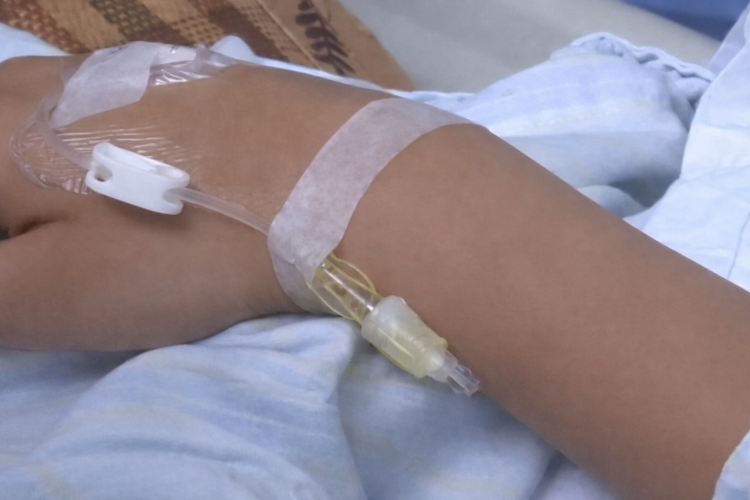 Nam sinh viên năm 2 qua đời sau chẩn đoán ung thư đại tràng, thủ phạm là 2 thói quen nhiều người lặp lại hàng ngày- Ảnh 2.