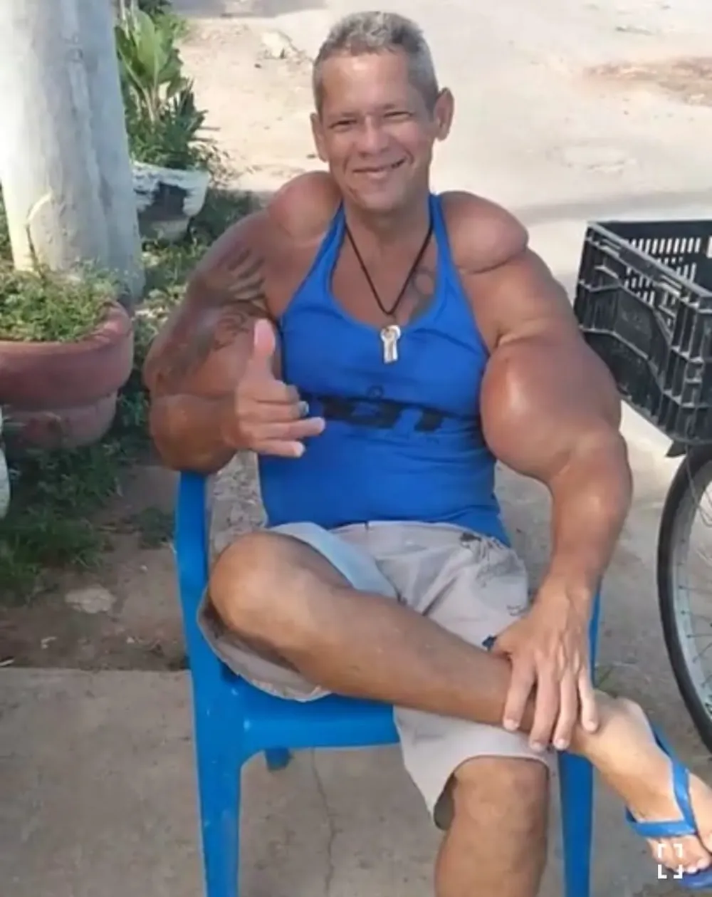 "Quái vật thể hình" Brazil sở hữu chu vi bắp tay lên tới 74cm đột ngột qua đời, bác sĩ cảnh báo 1 vấn đề sức khỏe tiềm ẩn- Ảnh 4.