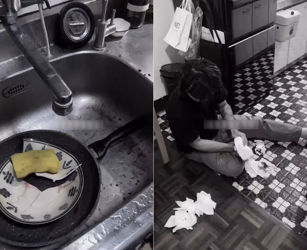 Rửa bát, tay người đàn ông chảy máu xối xả, phải khâu 4 mũi: Bác sĩ cảnh báo thói quen nhiều người mắc- Ảnh 1.