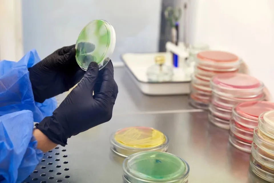 Không chỉ sữa bột, nhiều thực phẩm quen thuộc cũng có thể chứa vi khuẩn Bacillus cereus - thứ khiến Nestlé thu hồi sữa toàn cầu- Ảnh 3.