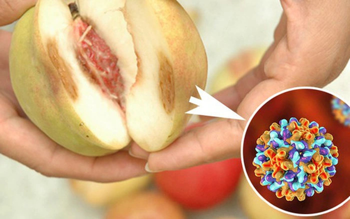 3 loại trái cây tế bào ung thư rất thích, có "bán rẻ như cho" cũng đừng động vào dù chỉ 1 lần!- Ảnh 3.