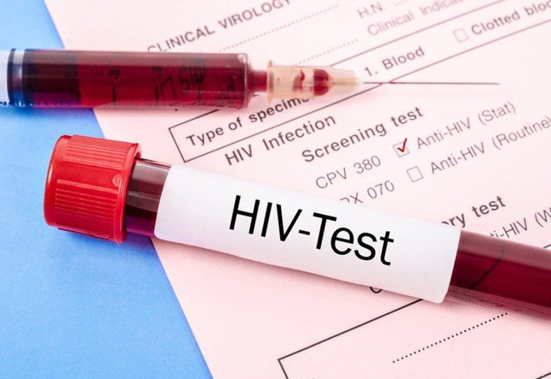 Nữ nhà báo 36 tuổi ngỡ ngàng phát hiện nhiễm HIV, liên tục tự trách chính mình: "Giá như tôi đừng làm thế..."- Ảnh 2.