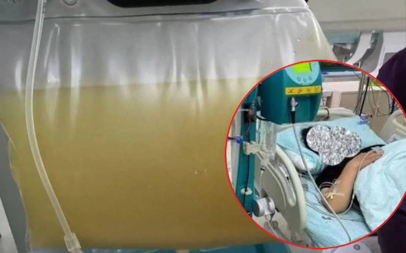 Người phụ nữ 38 tuổi đau bụng dữ dội, máu trắng đục như sữa, bác sĩ cảnh báo nguyên nhân từ thói quen ăn uống quen thuộc- Ảnh 3.