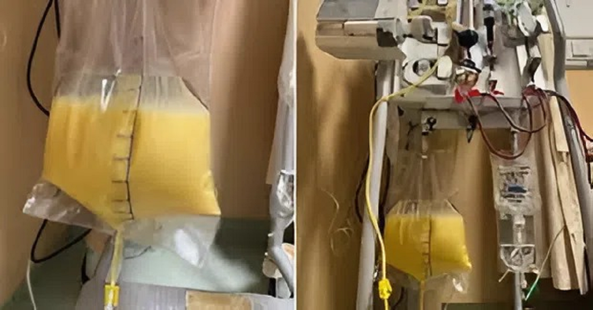 Người phụ nữ 32 tuổi "máu trắng như sữa", bác sĩ chỉ mặt điểm tên thói quen ít ai ngờ - Ảnh 1.