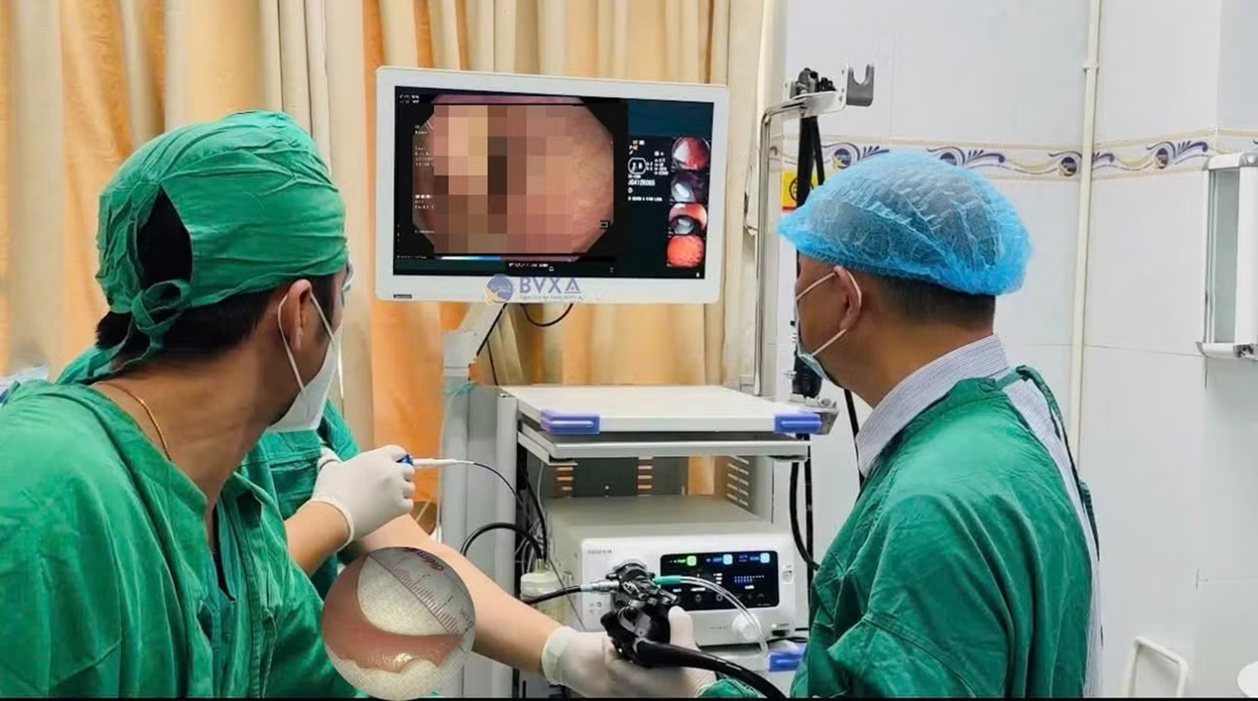 Người đàn ông 51 tuổi uống nước, bất ngờ nuốt nhầm thứ "không thể tin nổi" - Ảnh 1.