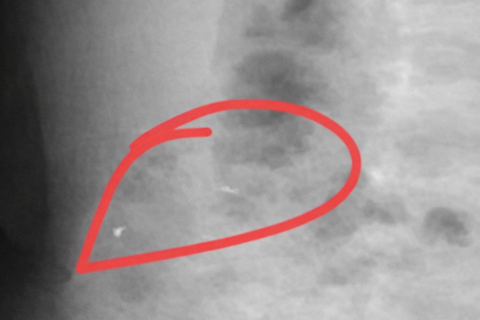 Nửa đêm nghe tiếng động lạ, mẹ hốt hoảng phát hiện con trai 1 tuổi đang nhai vàng- Ảnh 3.