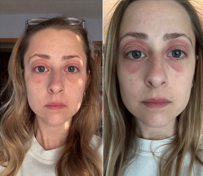 Bỏ 10 tỷ mua nhà, dọn vào ở được vài tháng, người phụ nữ mắc phải căn bệnh lạ khiến cơ thể biến dạng - Ảnh 1.