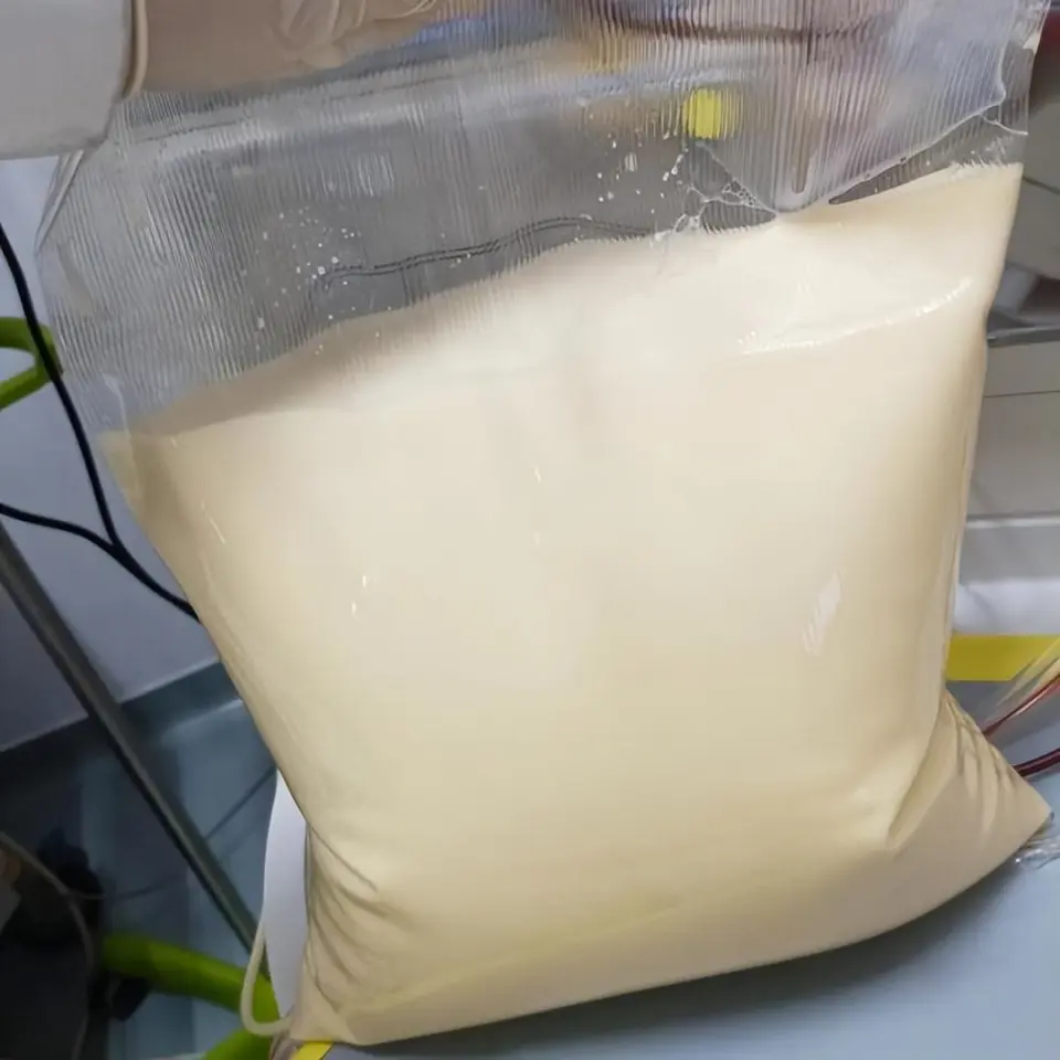 25 tuổi, máu chuyển trắng như sữa, cùng lúc mắc 3 bệnh nguy kịch: Bác sĩ cảnh báo lối sống này đang âm thầm “bôi mỡ” vào máu người trẻ - Ảnh 1.