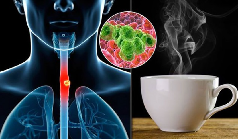 Loại nước Loại nước