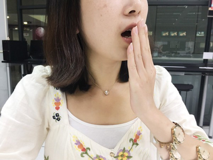 Ngày càng nhiều người còn trẻ đã trả giá vì ung thư gan? Bác sĩ nhắc: Đừng bỏ lỡ "2 hôi, 2 ngứa, 2 đỏ" đang báo bệnh- Ảnh 3.