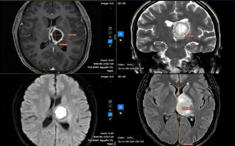 Thường xuyên buồn ngủ, đi khám “sốc” nặng khi biết nguyên nhân- Ảnh 1. Thường xuyên buồn ngủ, đi khám “sốc” nặng khi biết nguyên nhân- Ảnh 1.