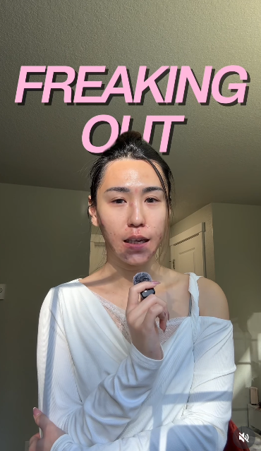 Bị đuổi việc, cô gái 27 tuổi để mặt mộc với mảng mụn lớn lên mạng tâm sự và cái kết bất ngờ- Ảnh 1.