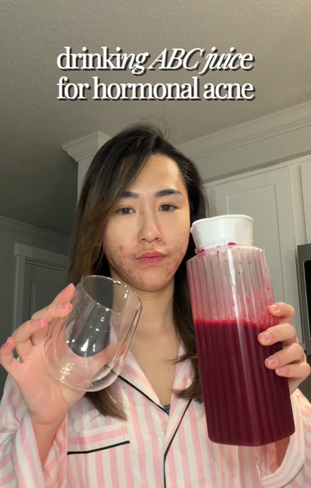 Bị đuổi việc, cô gái 27 tuổi để mặt mộc với mảng mụn lớn lên mạng tâm sự và cái kết bất ngờ- Ảnh 2.