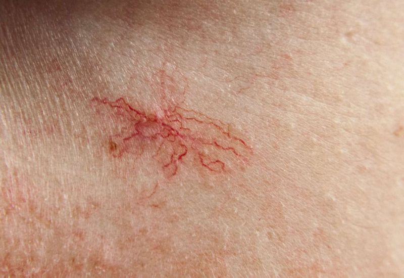 Muốn biết gan khỏe hay yếu, chỉ cần nhìn vào làn da sẽ rõ: Có 5 dấu hiệu này phải đi khám ngay- Ảnh 3.