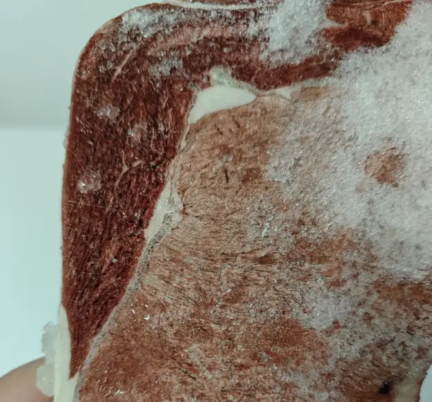 Thịt để tủ đá trông như thế này tốt nhất nên vứt đi, cho trẻ con ăn càng nguy hiểm! - Ảnh 2.