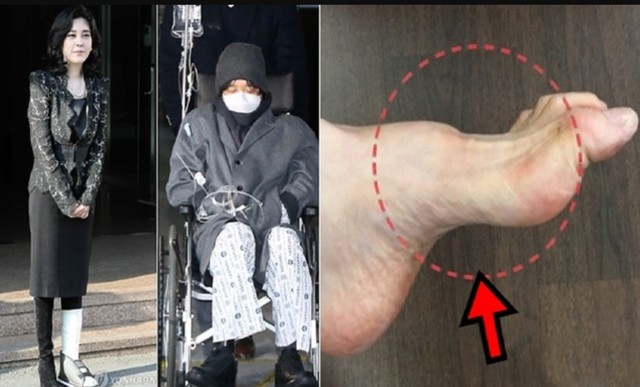 Gia tộc Samsung và căn bệnh di truyền đáng sợ mang tên teo cơ MÁC: Có tất cả nhưng cũng không thể chữa khỏi- Ảnh 5.