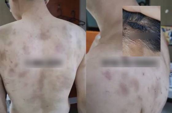 Rúng động Hàn Quốc: Nam nhân viên bị chủ quán hành hạ, ép làm việc 20 giờ/ngày, camera giám sát 24/7- Ảnh 1.